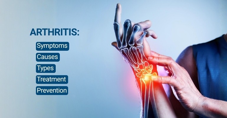 Arthritis: Symptoms, Causes, Types, Treatment and Prevention