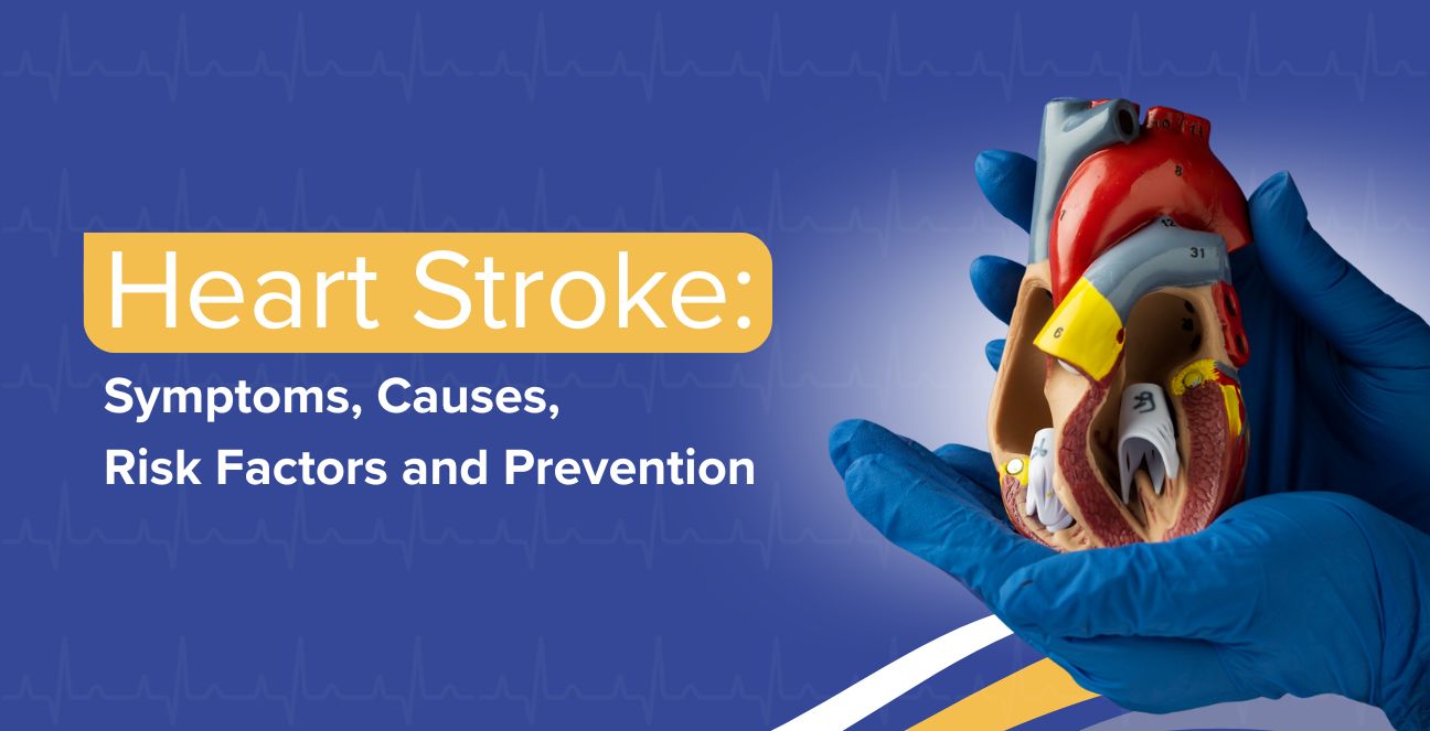 Heart Stroke: Symptoms, Causes, Risk Factors and Prevention