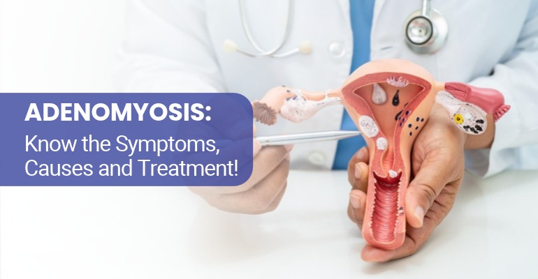 Adenomyosis