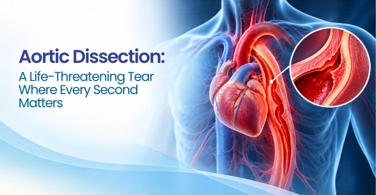 Aortic Dissection