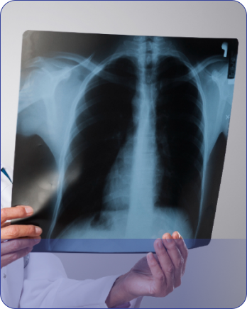 Pulmonology